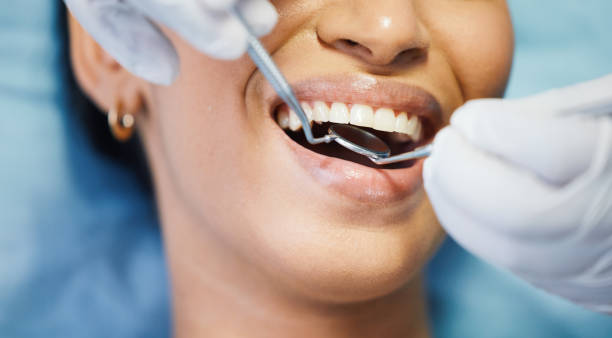 Best Emergency Wisdom Teeth Removal in Paradise Valley, AZ